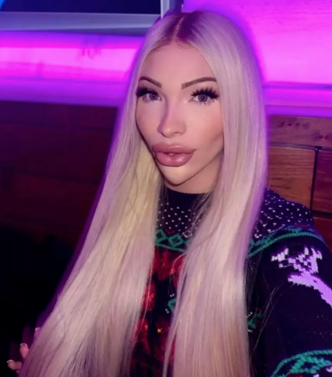 Une femme qui a dépensé 50 000 dollars en chirurgie pour ressembler à Marilyn Monroe veut maintenant retrouver son apparence naturelle.