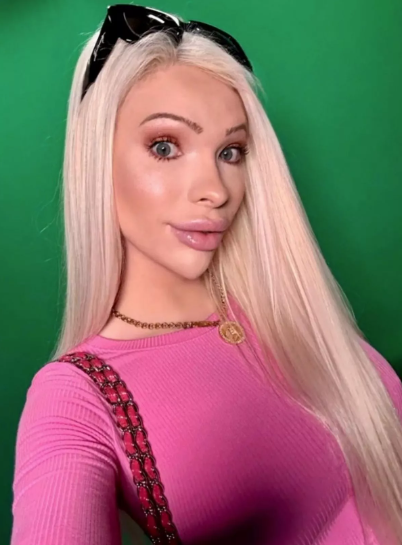 Une femme qui a dépensé 50 000 dollars en chirurgie pour ressembler à Marilyn Monroe veut maintenant retrouver son apparence naturelle.