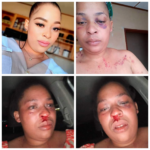 Une femme sud-africaine brutalement battue par son petit ami policier
