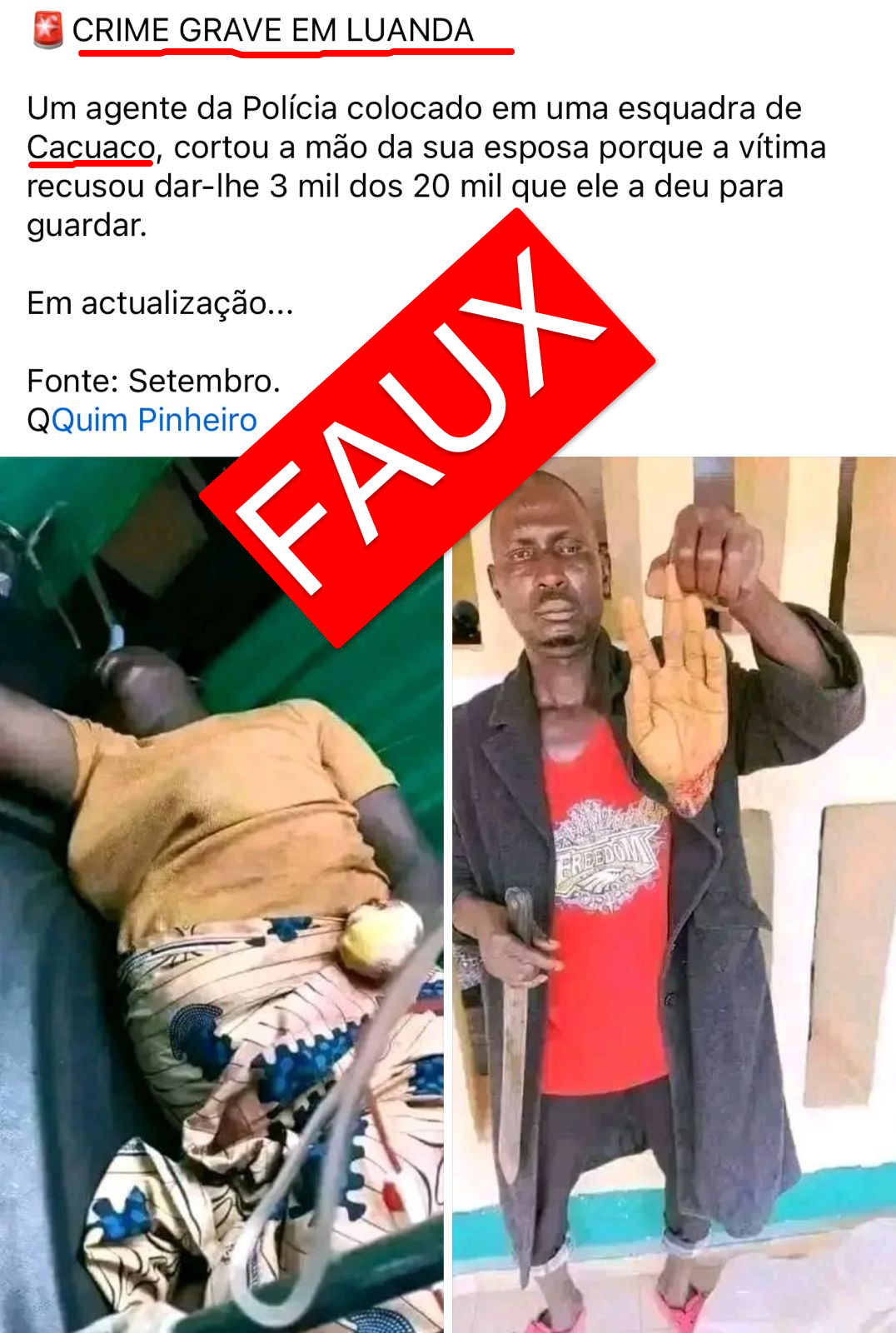 Côte d’Ivoire-AIP-Fact Checking/ FAUX, cette scène montrant la main sectionnée d’une femme ne s’est pas produite en Angola, mais au Nigeria