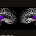 Les IRM révèlent les étapes stupéfiantes de la conscience dans le cerveau