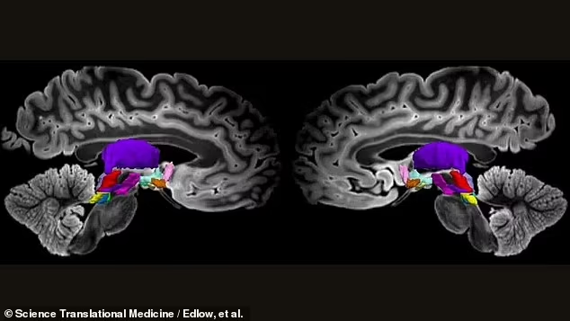  Les IRM révèlent les étapes stupéfiantes de la conscience dans le cerveau