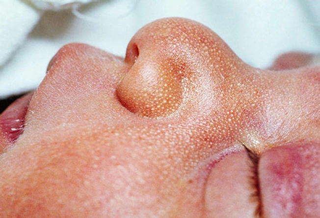 Diaporama sur les soins de la peau des bébés : Conseils simples pour garder la peau de bébé en bonne santé