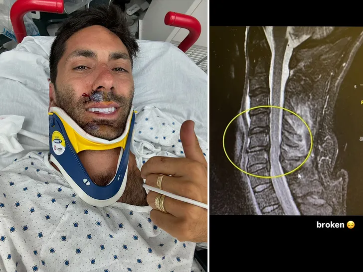  Nev Schulman se fracture le cou dans un accident de vélo