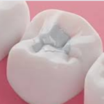 Attention à vos dents pour éviter les risques cardiaques !