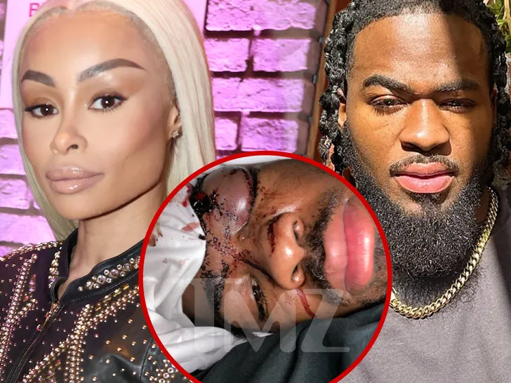  Blac Chyna poursuivie par son ex-petit ami, le rappeur Twin Hector, pour des accusations de violence domestique