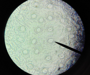 Découverte de nouveaux types de cellules graisseuses : une avancée pour comprendre l’obésité et ses risques pour la santé